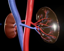 A National Renal Disease Fund to be established