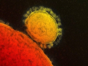 What Is MERS? Five Things to Know About the Mystery Virus