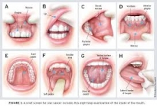 Sri Lanka's First Int'l Conference on Oral Cancer begins tomorrow